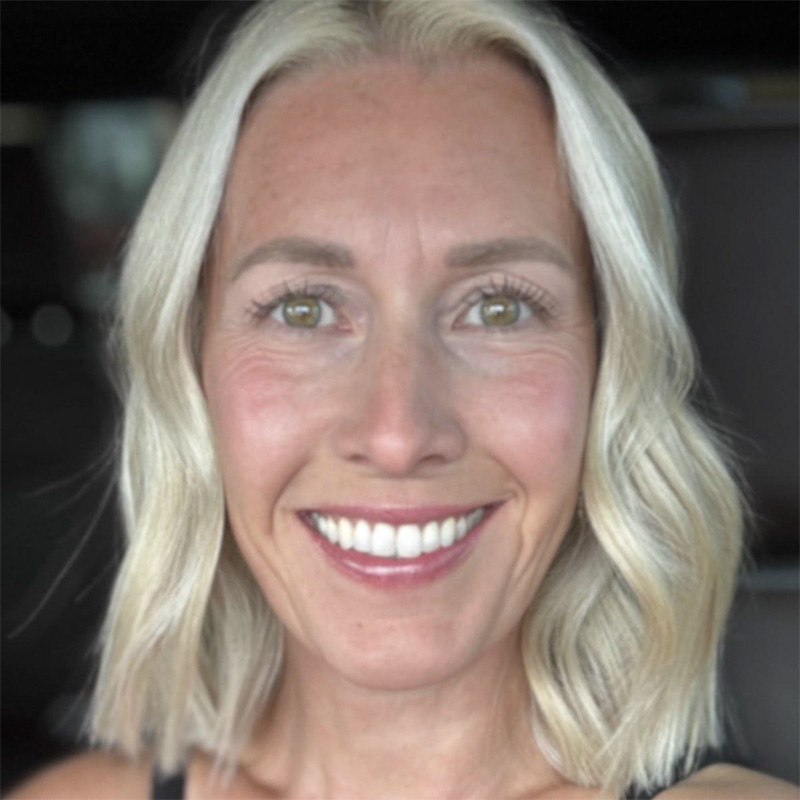 Darbie Brunner